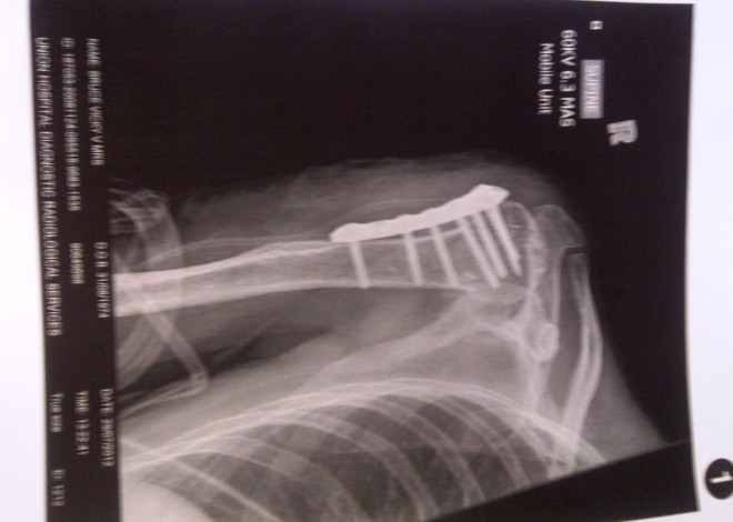 Alberton-20120729-00745