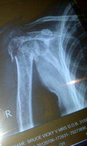 Alberton-20120706-00661